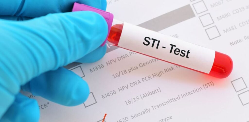 Xét nghiệm STDs – Kiểm tra sức khỏe tiền hôn nhân để bảo vệ sức khỏe sinh sản Xét nghiệm STDs – Kiểm tra sức khỏe tiền hôn nhân để bảo vệ sức khỏe sinh sản